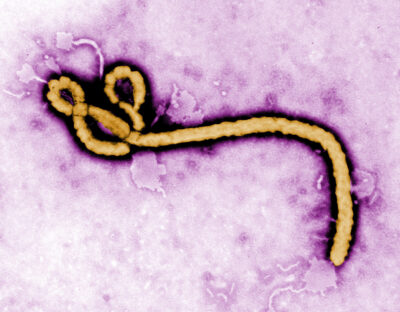 Immigration Restrictionists Exploit Ebola Tragedy